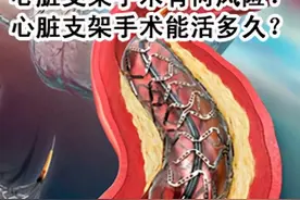 心脏放了支架后，会不会影响人的“寿命”？今天告诉你明确的答案图片