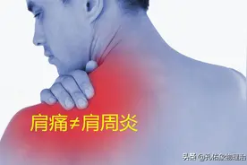 肩膀疼痛是咋回事？为啥不是肩周炎？本文告知您原因图片
