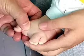 “30岁怀孕，孕6个月时发现宝宝脚有问题。”妈妈说着说着就哭了图片