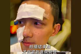 21岁吴磊拍戏脸部被炸伤！满脸伤口好心疼，收工才去医院太敬业图片