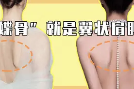 “蝴蝶骨”真的是瘦出来的吗？图片