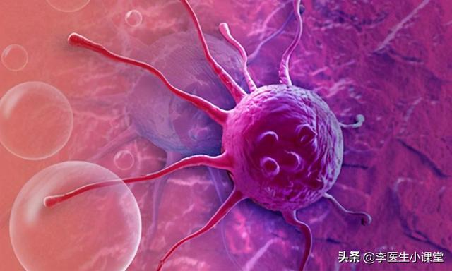 和癌症病人一起吃饭，会被传染吗？医生提醒：要注意这几个方面