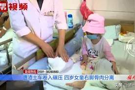 太心疼！四岁女童遭大车碾压，腿脚只剩下骨架，皮肉模糊图片