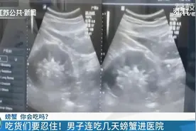 男子连吃几天螃蟹后腹痛如绞！怎样才能正确吃螃蟹？图片