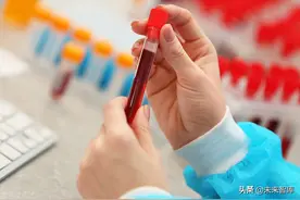 医疗化学发光检测行业研究：EQA，国产发光未来依旧星辰大海图片