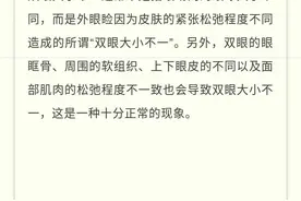 「儿童必学趣味小知识」为什么我的两只眼睛大小不一？图片