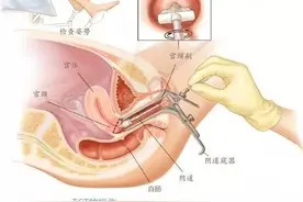 第一次妇检给你留下阴影了吗？图片