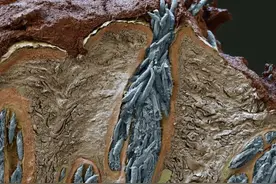 显微镜下的黑头图片