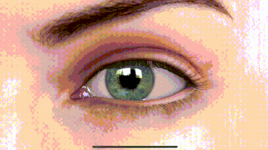 等等，你说可以用力学解释青光眼的致病机理？图片