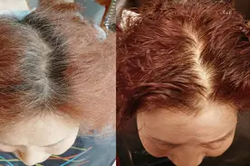 为什么很多老年人喜欢染红发？其实是染白发造成的，还是别染好图片