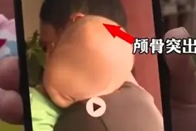 复盘郴州大头娃娃事件：或涉虚假宣传，已非当地首次出现奶粉问题图片