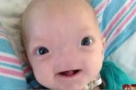 婴儿天生没有“鼻子”，全家崩溃，宝宝一个小小举动却让妈妈笑了图片