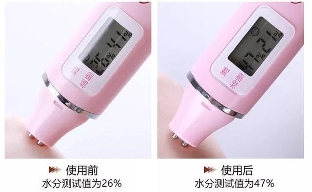 去粉刺毛囊炎痤疮鸡皮身体乳