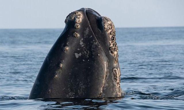 龟头里面有鸡皮疙瘩