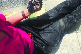 南通濠东路一施工道路沥青融化“粘倒”路人，伤者被送医图片