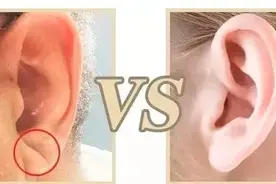 看一眼耳朵就能预测冠心病？还真不是忽悠你图片
