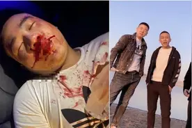 燕来座驾法拉利被撞报废。洋洋洋落泪痛哭感慨人生。​图片