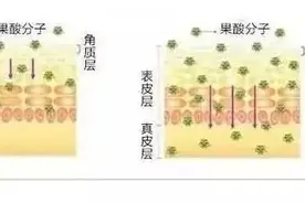 “果酸换肤”大揭秘，想要美白祛斑祛痘抗衰看这里！图片