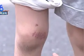 儿子上游泳私教课摔伤腿，沟通现场，前台：到外面等图片