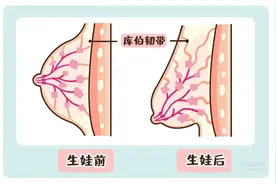喂奶后胸下垂、松弛、大小胸？先别瞎折腾！试试这么做图片