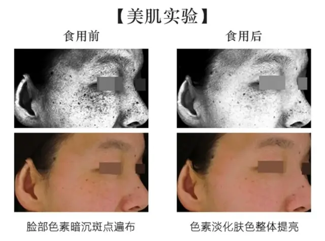 夏季怎样才能白到发光呢