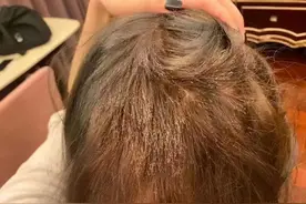 “我丑得出不了门！”女生花1000元染发成了这副模样：赔我20万！店长懵了图片