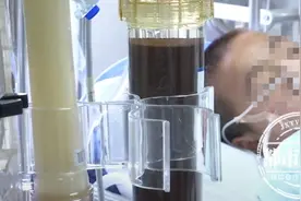 误把农药当饮料，9岁男童没了半条命！医生紧急提醒图片