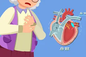 心律失常咋回事？心慌胸闷背后真相是啥？房颤发病机制动漫版图片