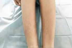 为什么有的女生体毛旺盛，有的却“光秃秃”？一起来了解一下图片