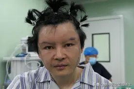 32岁小伙拉皮的心路历程，只为弥补磨骨的遗憾图片