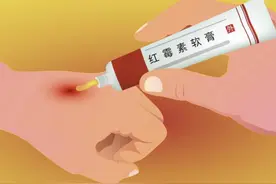 若将红霉素软膏涂在脸上，会有哪些效果？听医生怎么回应图片