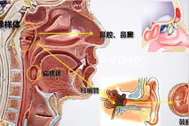 腺样体肥大的个体化治疗方案一网打尽！图片