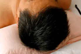 白发分别长在前额、两鬓、后脑勺，是什么情况？原因可能不是衰老图片