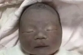 “黑脸宝宝”走红，刚出生时被家人嫌丑，两个月后却爱不释手图片