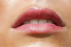 HPV阳性都是什么症状？其实看嘴唇周围出现这些情况就知道了图片