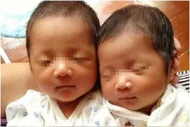 95后孕妈一胎生下两个娃，宝爸正准备庆祝，医生：这可不是双胞胎图片