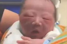 宝宝出生后因太“丑”遭全家嫌弃，医生却说很好看，满月后大变样图片