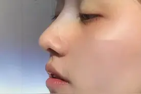 膨体也不是很好取出吧？图片
