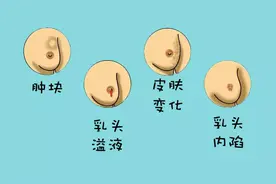 乳癌前兆是不痛的硬块！4种易忽略疾病，这种症状超两周马上就医图片