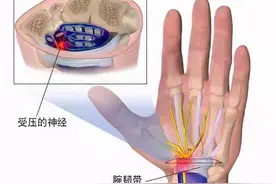 常手麻、手痛，究竟是哪里的问题？不出意外，这5种可能性最大图片