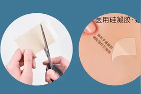 如何正确使用疤痕凝胶和疤痕贴？图片