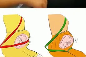 网友分享特殊场合才用到的工具…居然还有专门铲人的车？图片