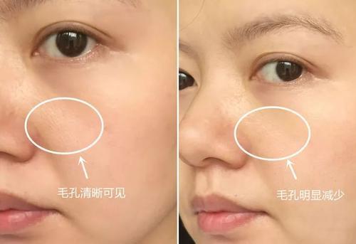 “宝藏女孩”赵露思直播卸妆，看到真实皮肤状态，网友：别化妆了