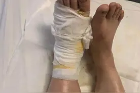 小心毒蛇！台风过，群蛇动，专家：蛇也受灾，宁波已有人被咬伤图片