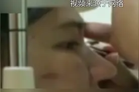 睡了一觉，隐形眼镜跑到了眼球后面！还有人佩戴后眼镜碎在了眼睛里图片