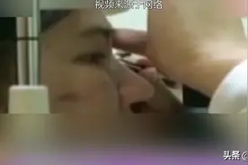 睡了一觉，隐形眼镜跑到了眼球后面！还有人佩戴后眼镜碎在了眼睛里图片
