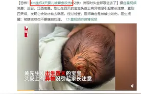 吓到！出生仅4天的婴儿被蜱虫咬伤，发现时蜱虫的头全部吸进去了图片