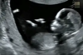 宝宝在妈妈肚子里都做了些什么？会哭会笑会玩耍，一点都不寂寞图片