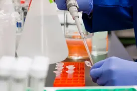 乙肝治疗：胆红素轻微升高有益于身体健康？图片