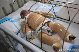 乡村纪事：偏方治大病，不识字的母亲，是个厉害的“土郎中”图片